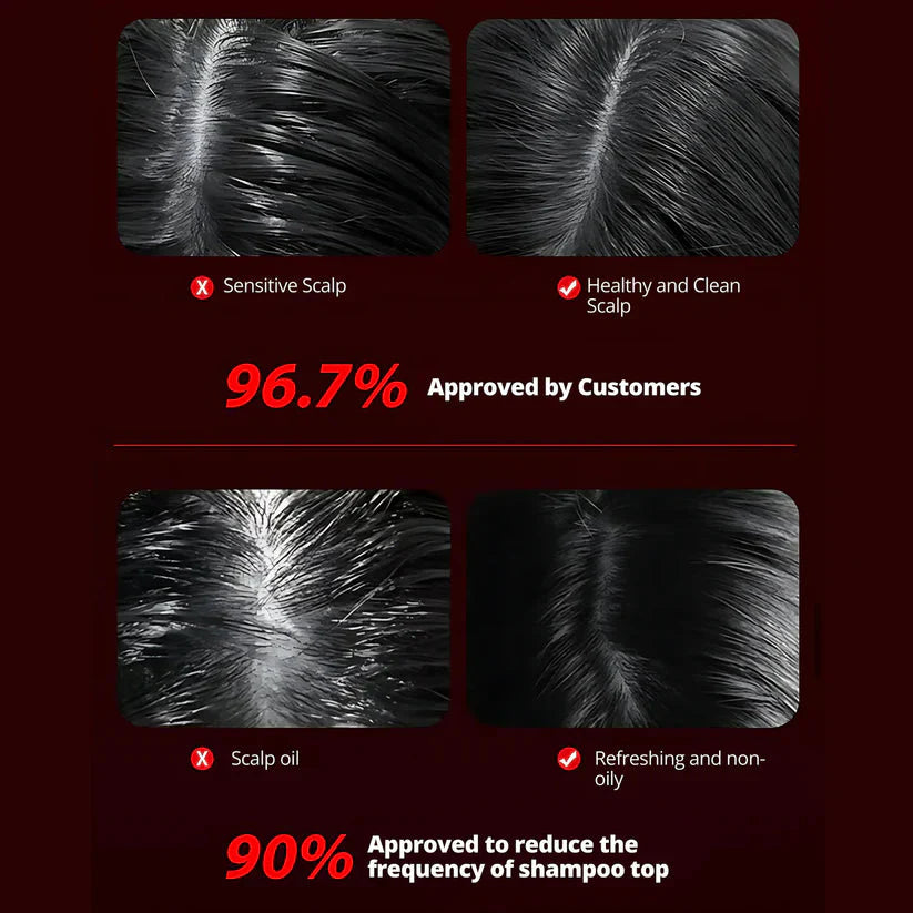 ScalpBoost™ Red Light Therapy Electric Comb